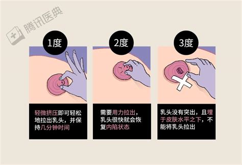 乳房有毛|乳头边上有毛毛正常吗？10 个你需要知道的小问题